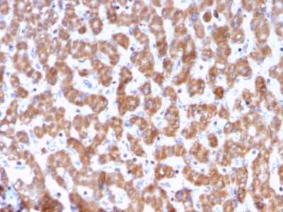 Immunohistochemistry-Paraffin: Prohibitin Antibody (PHB/3228) - Azide and BSA Free [NBP3-08337]