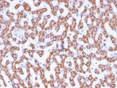 Immunohistochemistry-Paraffin: Prohibitin Antibody (PHB/3230) - Azide and BSA Free [NBP3-08687]