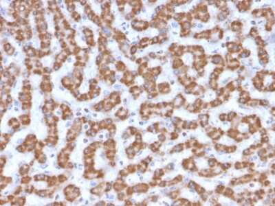 Immunohistochemistry-Paraffin: Prohibitin Antibody (PHB/3230) - Azide and BSA Free [NBP3-08687]