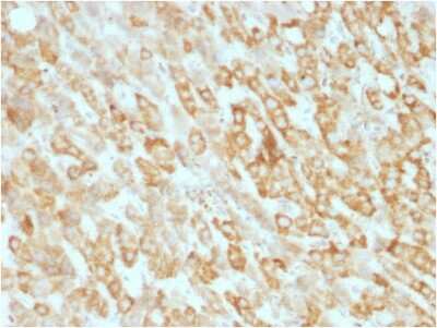 Immunohistochemistry-Paraffin: Prohibitin Antibody (SPM311) [NBP3-07832]