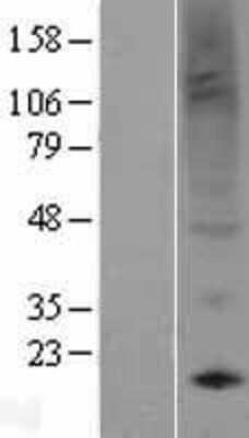 Western Blot: EG-VEGF/PK1 Overexpression Lysate [NBL1-14806]