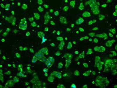 Immunocytochemistry/ Immunofluorescence: Prolactin Antibody (OTI6B1) [NBP2-02142]