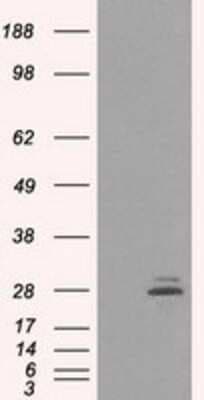 Western Blot: Prolactin Antibody (OTI6B1) [NBP2-02142]