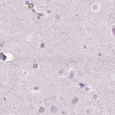 Immunohistochemistry-Paraffin: Prolactin Antibody [NBP2-56148]
