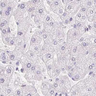 Immunohistochemistry-Paraffin: Prolactin Antibody [NBP2-56148]