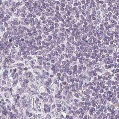 Immunohistochemistry-Paraffin: Prolactin Antibody [NBP2-56148]