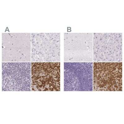 Immunohistochemistry-Paraffin: Prolactin Antibody [NBP2-56148]