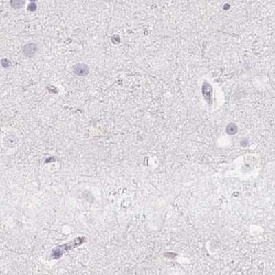 Immunohistochemistry-Paraffin: Prolactin Antibody [NBP2-59010]
