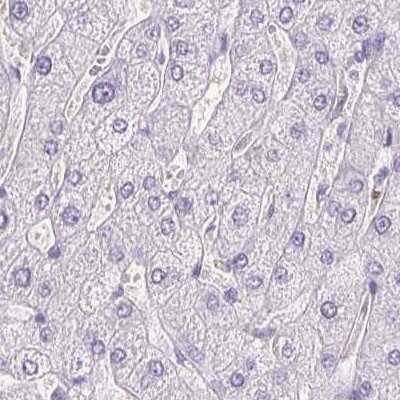 Immunohistochemistry-Paraffin: Prolactin Antibody [NBP2-59010]