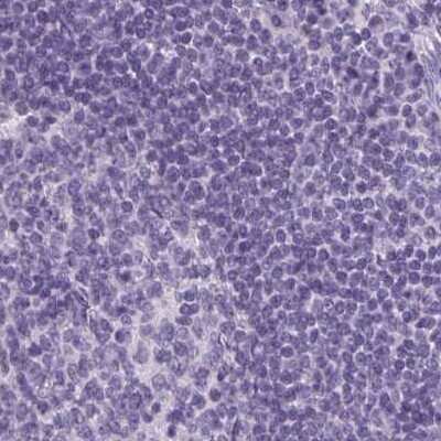 Immunohistochemistry-Paraffin: Prolactin Antibody [NBP2-59010]