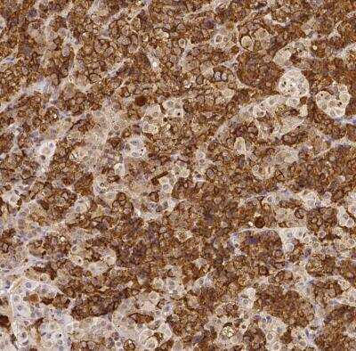 Immunohistochemistry-Paraffin: Prolactin Antibody [NBP2-59010]