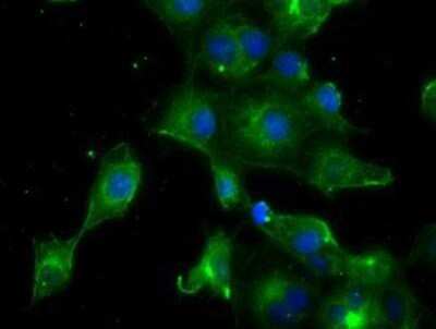 Immunocytochemistry/ Immunofluorescence: Prolactin Antibody (OTI6B1) - Azide and BSA Free [NBP2-73609]