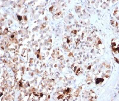 Immunohistochemistry-Paraffin: Prolactin Antibody (PRL/4906R) [NBP3-13755]