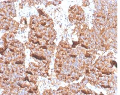 Immunohistochemistry-Paraffin: Prolactin Antibody (PRL/4906R) [NBP3-13755]