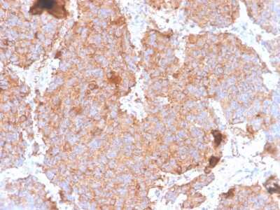 Immunohistochemistry-Paraffin: Prolactin Antibody (PRL/4908R) - Azide and BSA Free [NBP3-08249]