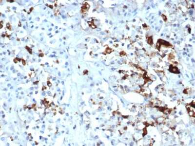 Immunohistochemistry-Paraffin: Prolactin Antibody (PRL/4908R) - Azide and BSA Free [NBP3-08249]
