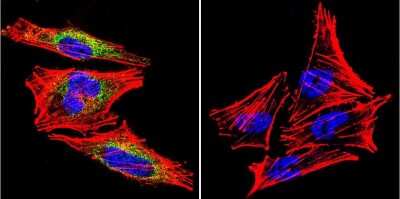 Immunocytochemistry/ Immunofluorescence: Prolactin R Antibody (U5) [NB300-561]