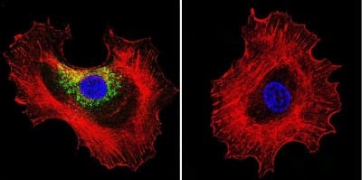 Immunocytochemistry/ Immunofluorescence: Prolactin R Antibody (U5) [NB300-561]