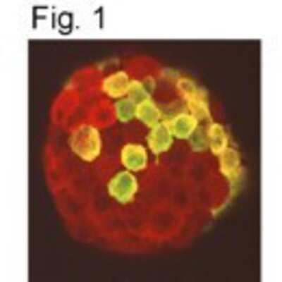 Immunohistochemistry: Prolactin R Antibody (U5) [NB300-561]