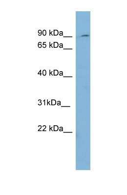 Western Blot: Prolyl Oligopeptidase/PREP Antibody [NBP1-56842]
