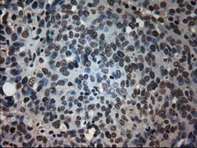 Immunohistochemistry: Prominin 2 Antibody (OTI6B7) - Azide and BSA Free [NBP2-73616]
