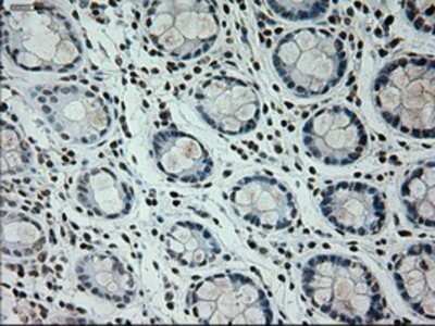 Immunohistochemistry: Prominin 2 Antibody (OTI6B7) - Azide and BSA Free [NBP2-73616]