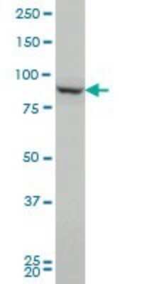 Western Blot: Proprotein Convertase 1/PCSK1 Antibody (3D2) [H00005122-M02]