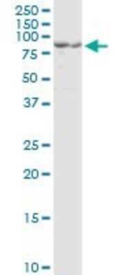 Western Blot: Proprotein Convertase 1/PCSK1 Antibody (3D2) [H00005122-M02]