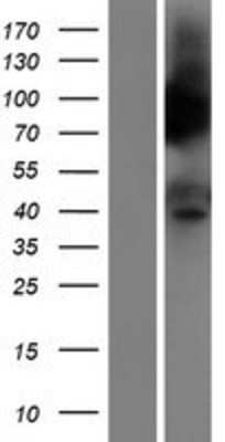 Western Blot: PTGER3 Overexpression Lysate [NBL1-14933]