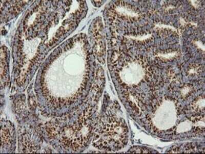 Immunohistochemistry: Prostaglandin E Synthase 2/PTGES2 Antibody (OTI2C3) - Azide and BSA Free [NBP2-73623]