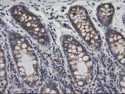 Immunohistochemistry: Prostaglandin E Synthase 2/PTGES2 Antibody (OTI2C3) - Azide and BSA Free [NBP2-73623]