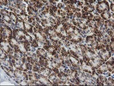 Immunohistochemistry: Prostaglandin E Synthase 2/PTGES2 Antibody (OTI2C3) - Azide and BSA Free [NBP2-73623]