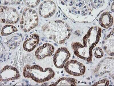 Immunohistochemistry: Prostaglandin E Synthase 2/PTGES2 Antibody (OTI2C3) [NBP2-45904]