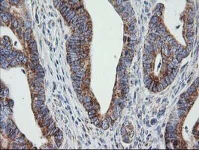 Immunohistochemistry: Prostaglandin E Synthase 2/PTGES2 Antibody (OTI2C3) [NBP2-45904]