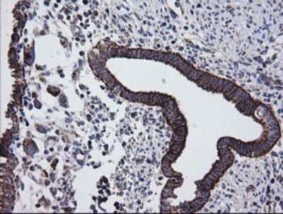 Immunohistochemistry: Prostaglandin E Synthase 2/PTGES2 Antibody (OTI2C3) [NBP2-45904]