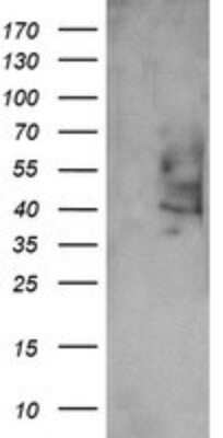 Western Blot: Prostaglandin E Synthase 2/PTGES2 Antibody (OTI2C3) [NBP2-45904]