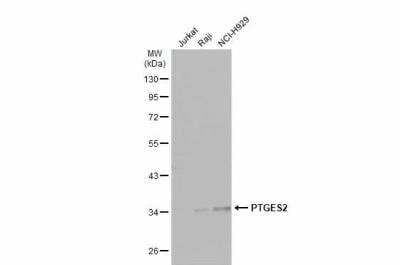 Western Blot: Prostaglandin E Synthase 2/PTGES2 Antibody [NBP1-33411]