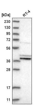 Western Blot: Prostaglandin E Synthase 2/PTGES2 Antibody [NBP2-58108]