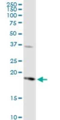 Western Blot: Prostaglandin E Synthase Antibody [H00009536-D01P]