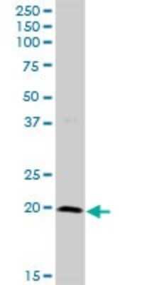 Western Blot: Prostaglandin E Synthase Antibody [H00009536-D01P]