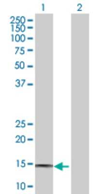 Western Blot: Prostaglandin E Synthase Antibody [H00009536-D01P]