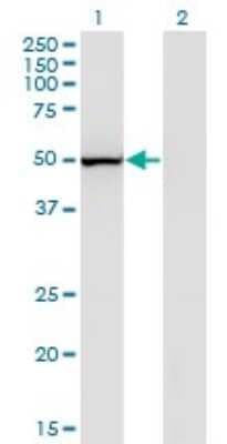 Western Blot: Prostaglandin I2 Synthase Antibody (3B11) [H00005740-M02]