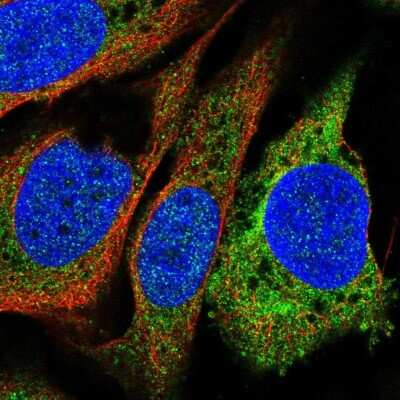 Immunocytochemistry/ Immunofluorescence: Prostaglandin I2 Synthase Antibody [NBP2-68701]