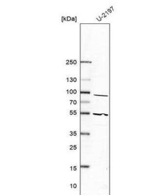 Western Blot: Prostaglandin I2 Synthase Antibody [NBP1-85359]