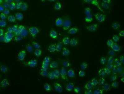 Immunocytochemistry/ Immunofluorescence: PSP94/MSMB Antibody (OTI6C7) [NBP2-02450]