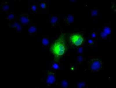 Immunocytochemistry/ Immunofluorescence: PSP94/MSMB Antibody (OTI6C7) [NBP2-02450]