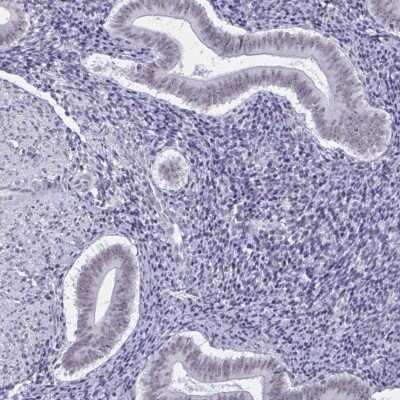 Immunohistochemistry-Paraffin: PSP94/MSMB Antibody [NBP2-33610]