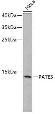 Western Blot: Prostate and testis expressed protein 3 AntibodyBSA Free [NBP3-05564]