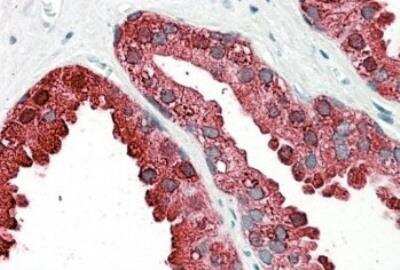 Immunohistochemistry-Paraffin: Prostatic Acid Phosphatase/ACPP Antibody [NBP1-78280]