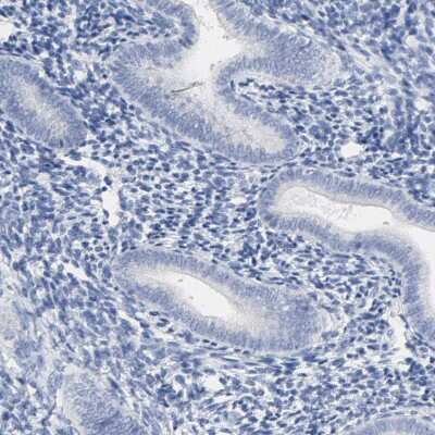 Immunohistochemistry-Paraffin: Prostatic Acid Phosphatase/ACPP Antibody [NBP1-90263]